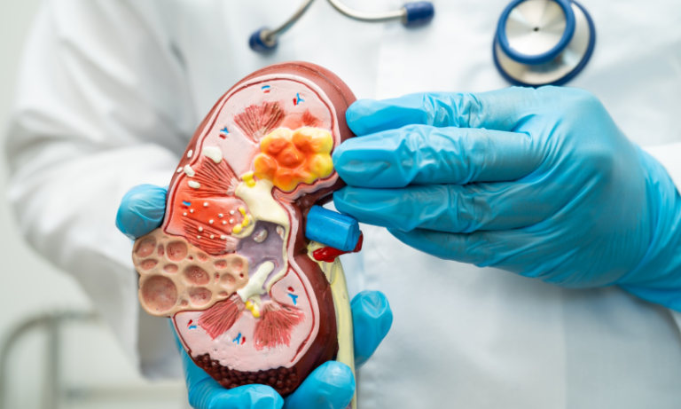 Nephrology