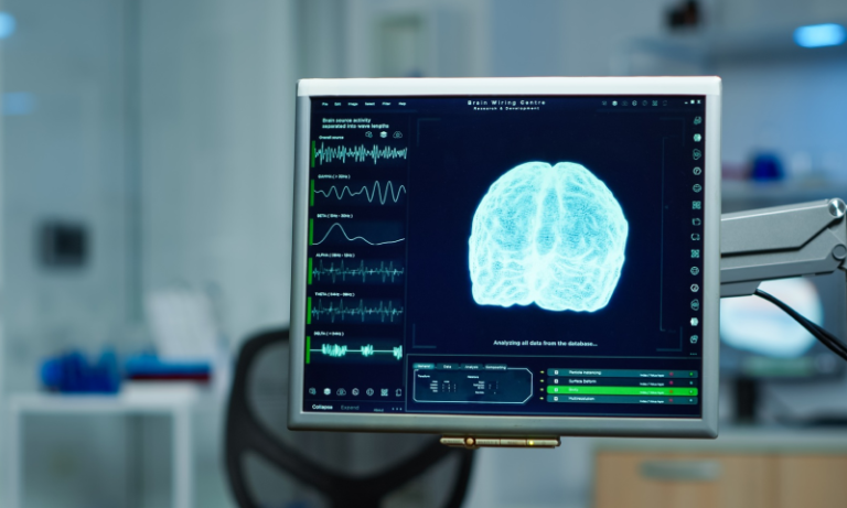 Neurology